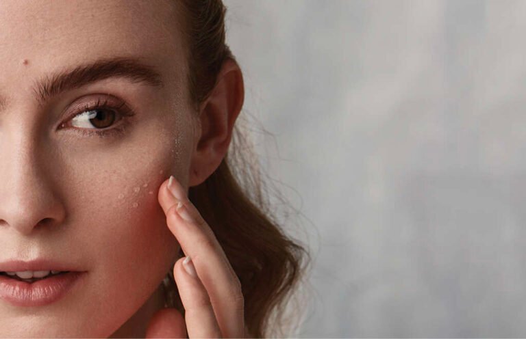 Calm & Clear: Expert Tips for Sensitive Skin